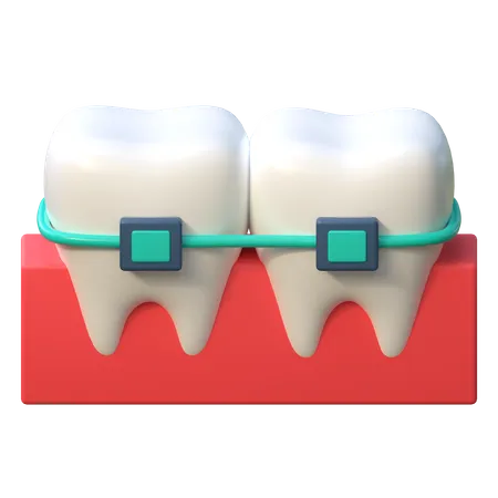 Icone Dappareil Dentaire Dalignement Des Dents Illustration 3 D De Soins Dentaires 3D Icon