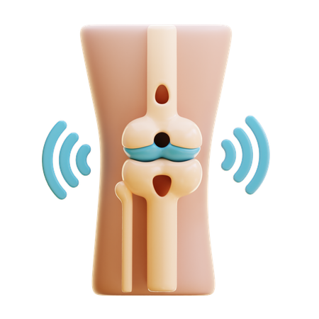 Osteoartritis  3D Icon