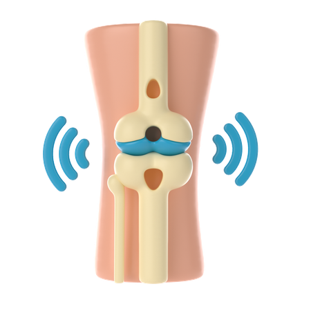 Osteoartritis de rodilla  3D Icon