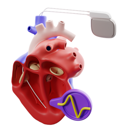 Pacemaker The Heart  3D Icon