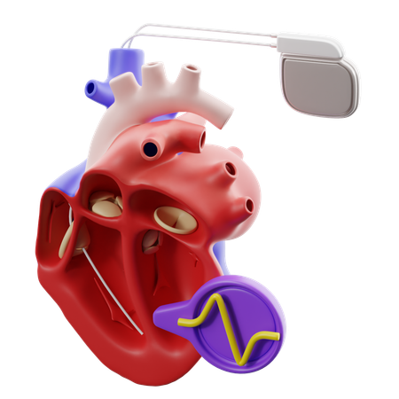 Pacemaker The Heart  3D Icon