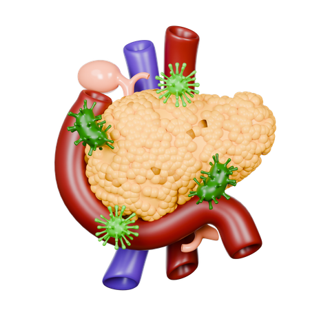 췌장 질환  3D Icon