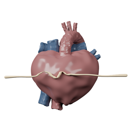 Paro cardiaco  3D Icon