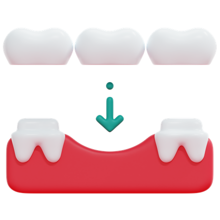 Pont de dents  3D Icon
