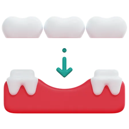 Pont de dents  3D Icon
