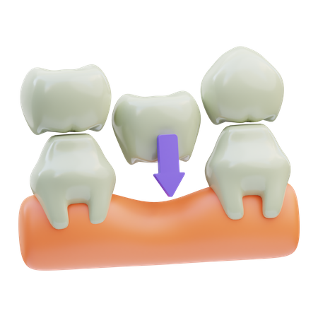 Pont dentaire  3D Icon