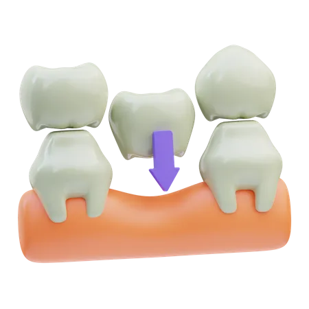 Pont dentaire  3D Icon
