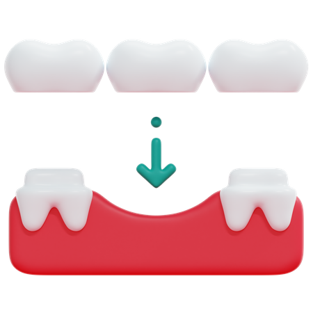 Ponte de dentes  3D Icon