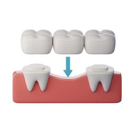 Ponte de dentes  3D Icon