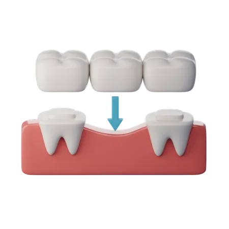 Ponte de dentes  3D Icon