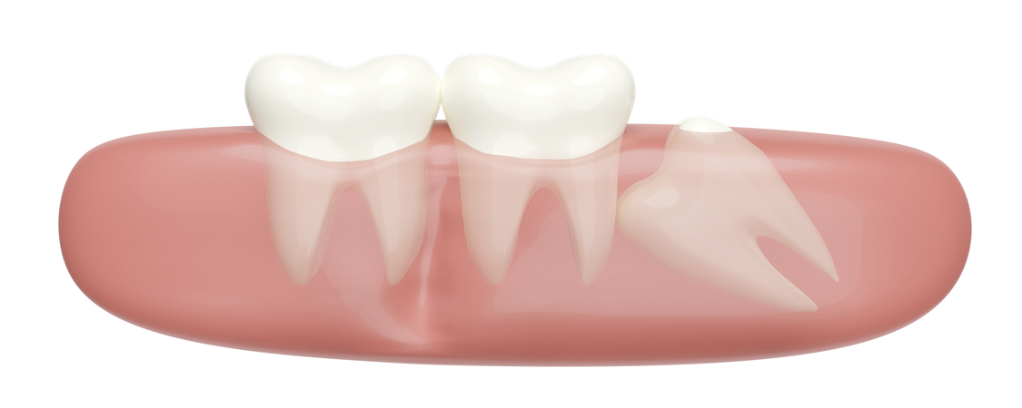 Problemas con el modelo de dientes.  3D Illustration