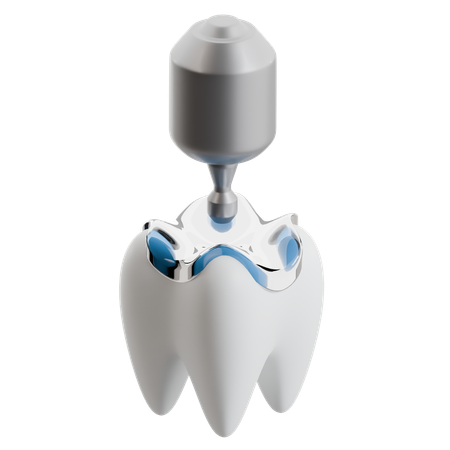 Procedimiento de implante dental  3D Icon