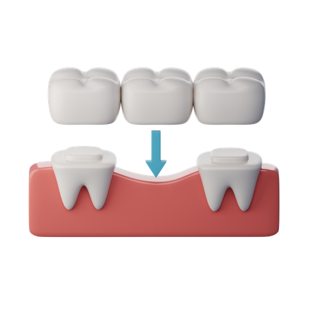 Puente de dientes  3D Icon