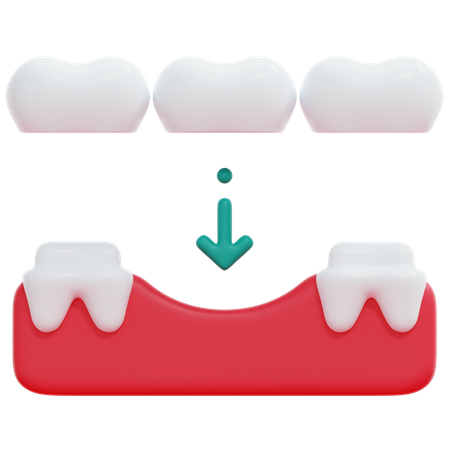 Puente de dientes  3D Icon