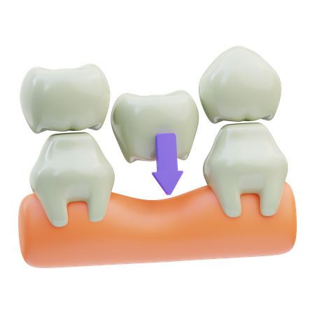 Puente dental  3D Icon