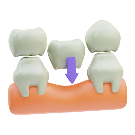 Puente dental  3D Icon