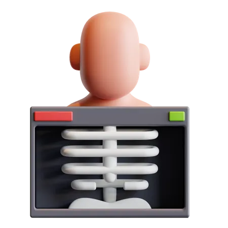Raio X dos pulmões  3D Illustration