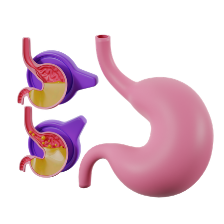 Reflujo gastroesofágico  3D Icon