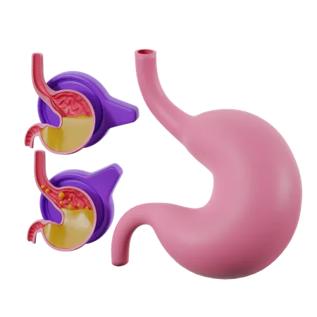 Refluxo gastroesofágico  3D Icon