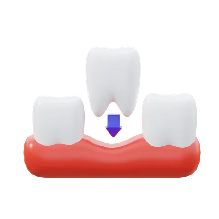 Remplissage des dents  3D Icon