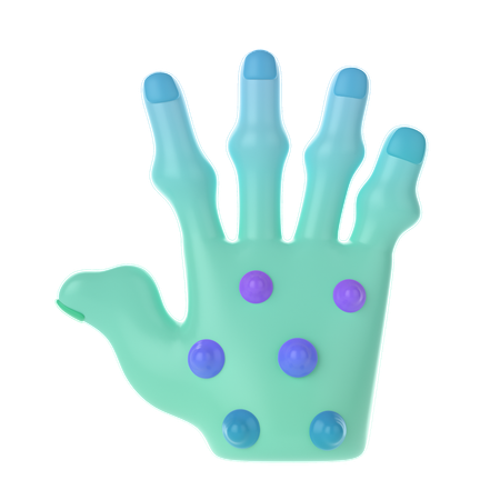 Rheumatoid Nodules Palm  3D Icon