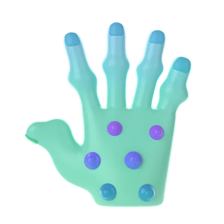 Rheumatoid Nodules Palm  3D Icon