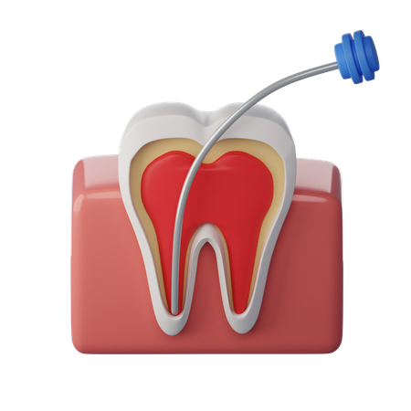 Root Canal Treatment  3D Icon