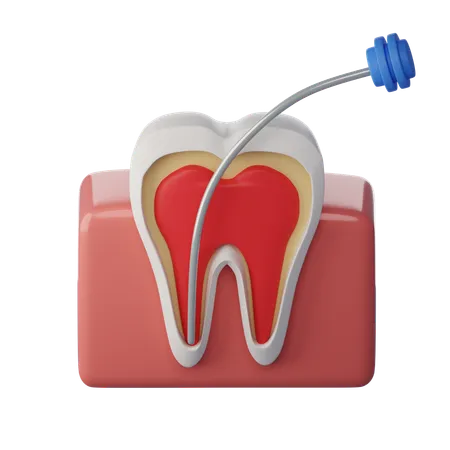 Root Canal Treatment  3D Icon