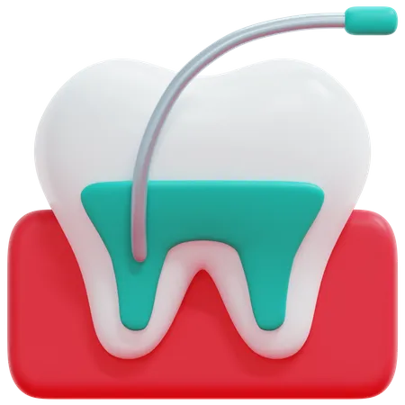 Root Canal Treatment  3D Icon