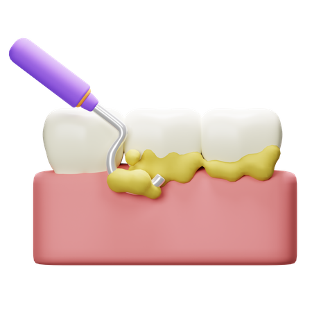 Scaling Tooth  3D Icon