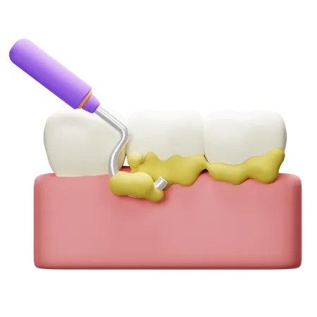 Scaling Tooth  3D Icon