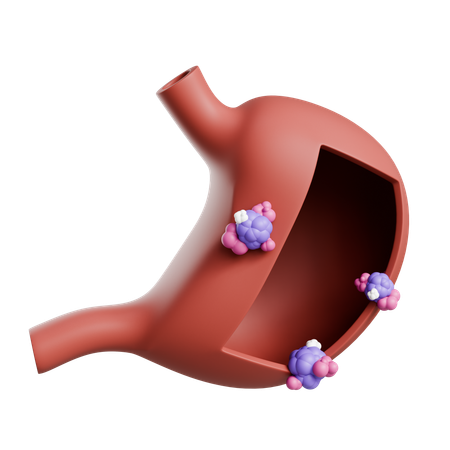 Stomach Cancer  3D Icon