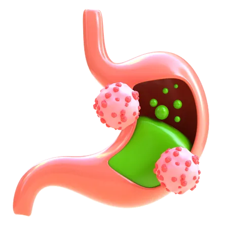 Stomach Cancer  3D Icon