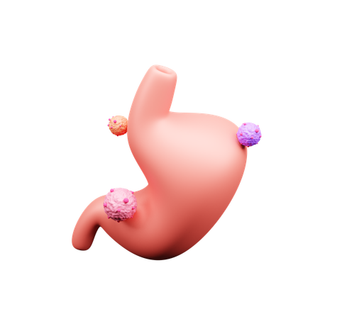 Stomach Cancer  3D Icon