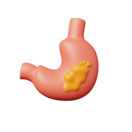 Stomach Cancer  3D Icon