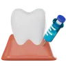 Teeth Anesthesia