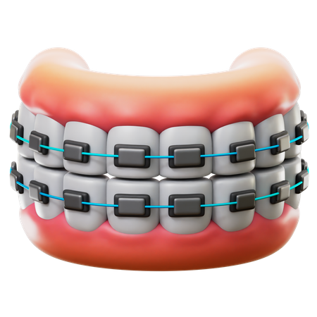 Teeth Braces 3D Icon