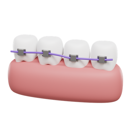 Teeth Braces  3D Icon