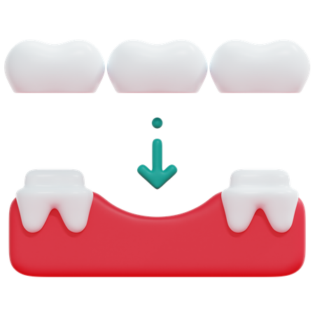 Teeth Bridge 3D Icon