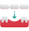 Teeth Bridge