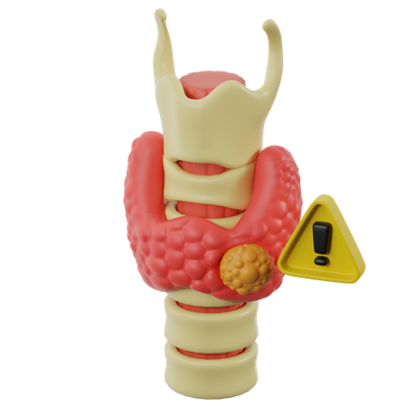 Thyroid Nodules And Cancer  3D Icon
