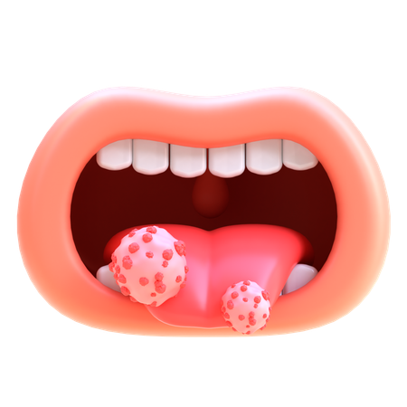 Tongue Cancer  3D Icon