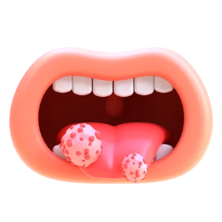 Tongue Cancer  3D Icon