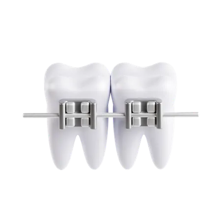 Tooth Brace  3D Icon