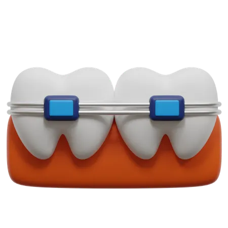 Tooth Braces From Dentist 3 D Icon 3D Icon