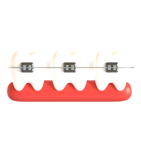 Tooth Braces  3D Icon