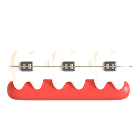 Tooth Braces  3D Icon