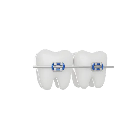 Teeth Braces 3 D Render Icon 3D Icon