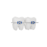 3d tooth braces logo
