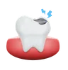 Tooth Cavity